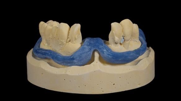 Newsletter 79 – Creating a wonderful smile and changing a life.