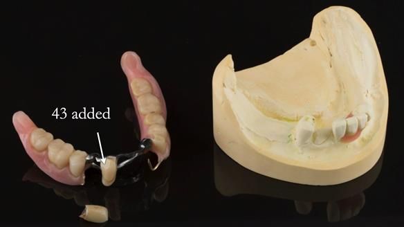 Ken – going downhill, first class