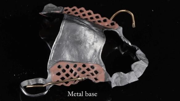 Finlay's Newsletter 60 Sylvia's upper Kennedy Class 2 Mod 1 metal based upper RPD