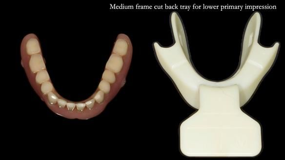 Newsletter 75: Marion’s case - Step-by-step complete denture workflow