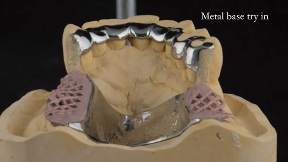 Ken – going downhill, first class