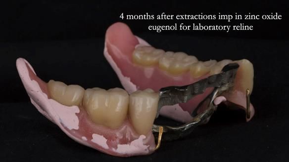 Ken – going downhill, first class