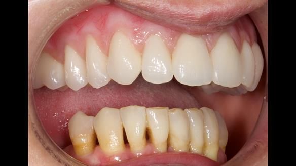 Newsletter 79 – Creating a wonderful smile and changing a life.