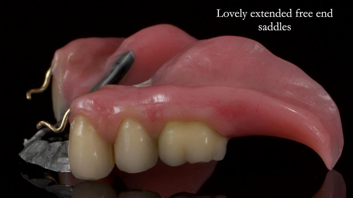 Newsletter 87 – Father Peter: A Partial Denture that needed Minor Miracle