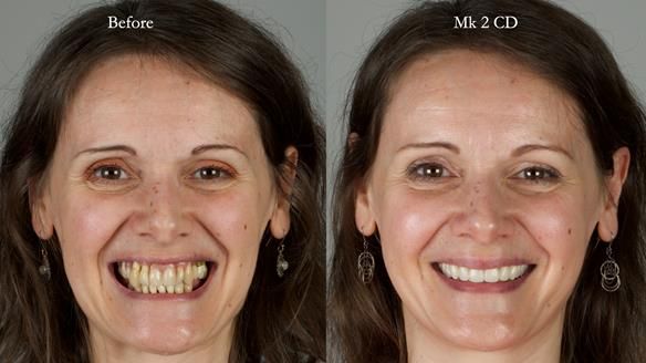 Newsletter 79 – Creating a wonderful smile and changing a life.