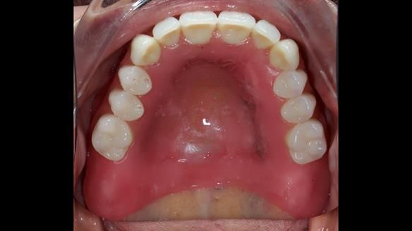 Newsletter 79 – Creating a wonderful smile and changing a life.