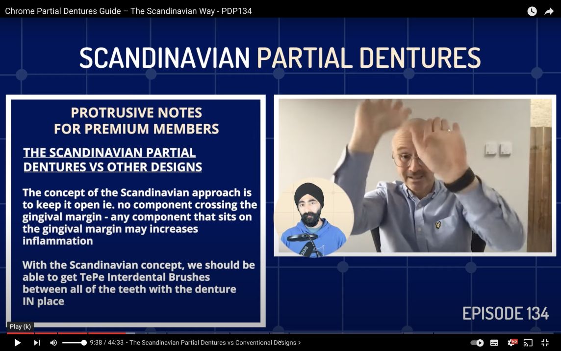 Chrome Partial Dentures Guide – The Scandinavian Way
