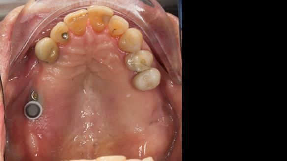 Ken – going downhill, first class