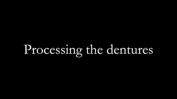 Newsletter 78: What do Clark Gable and a Locator® overdenture have in common?