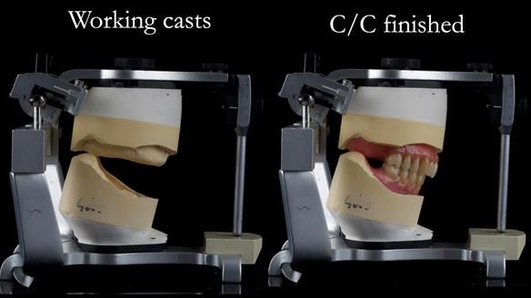 Newsletter 50 Special edition Complete Dentures FULL PROTOCOL