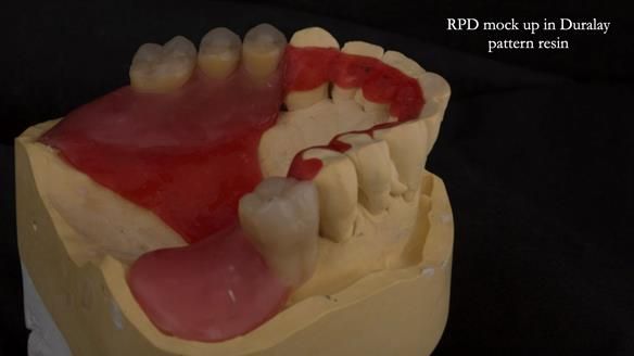Ken – going downhill, first class