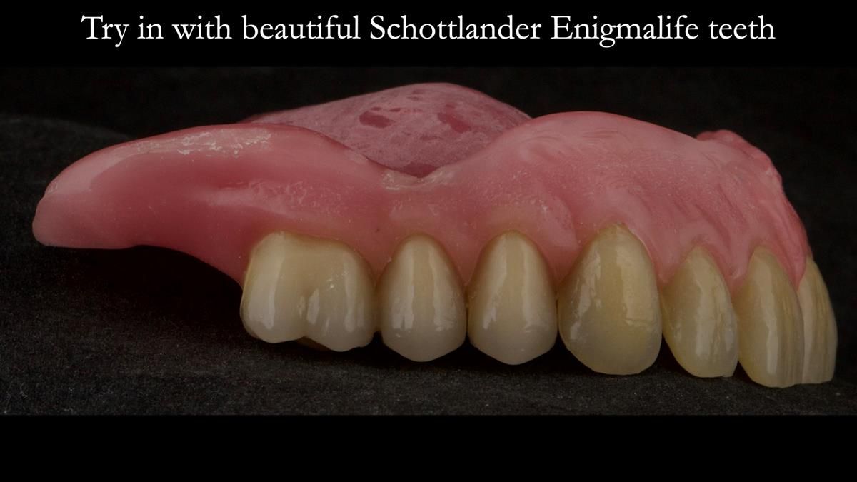 Newsletter 87 – Father Peter: A Partial Denture that needed Minor Miracle