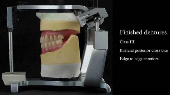 Finished dentures