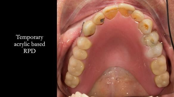 Ken – going downhill, first class