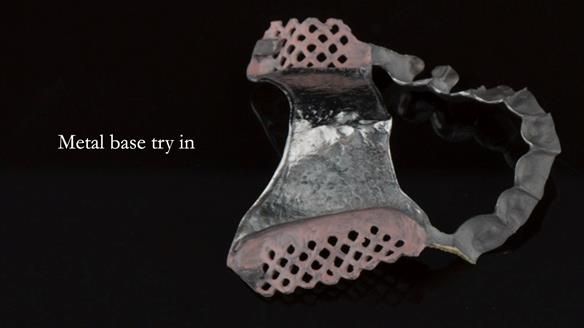 Ken – going downhill, first class