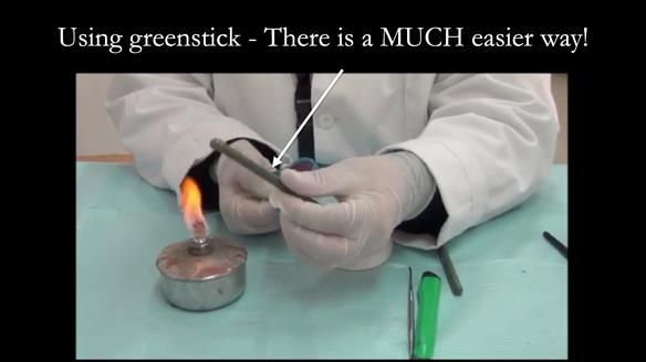 Newsletter 75: Marion’s case - Step-by-step complete denture workflow