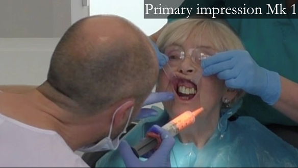 Figure 11 Primary impression taking