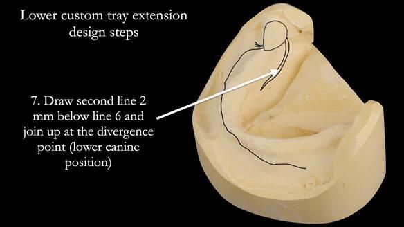 Newsletter 50 Special edition Complete Dentures FULL PROTOCOL