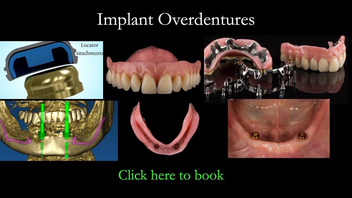Newsletter 87 – Father Peter: A Partial Denture that needed Minor Miracle