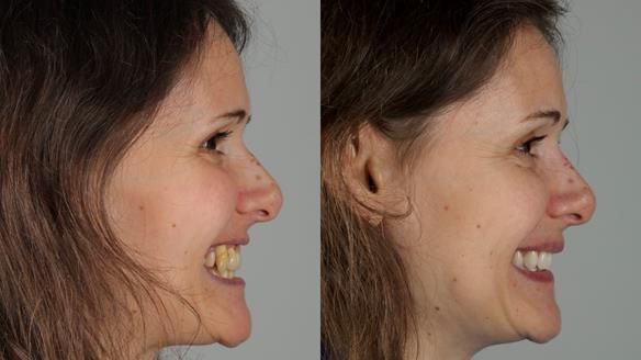 Newsletter 79 – Creating a wonderful smile and changing a life.