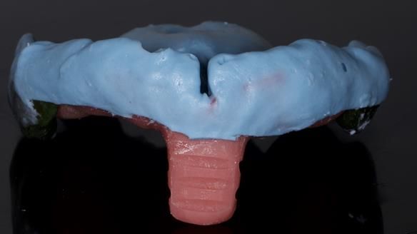 Newsletter 79 – Creating a wonderful smile and changing a life.