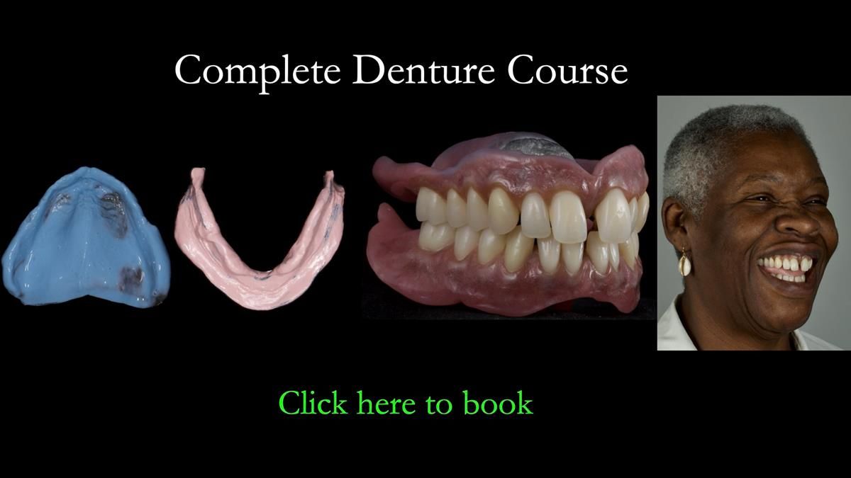 Newsletter 87 – Father Peter: A Partial Denture that needed Minor Miracle