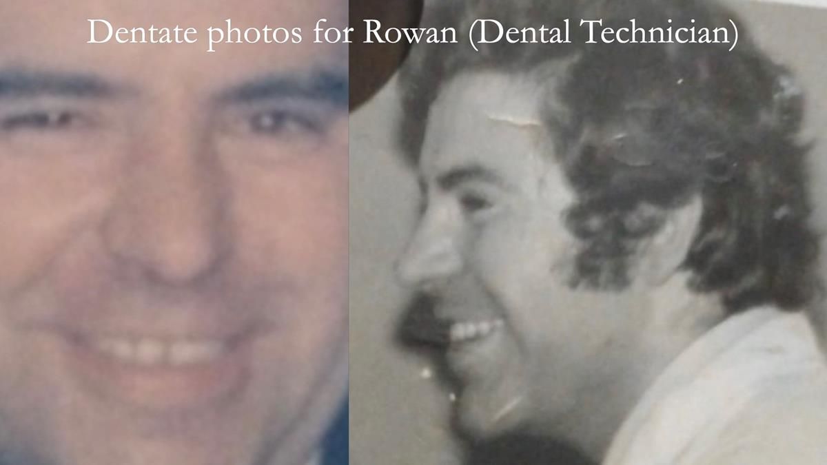 Fin’s Newsletter 88 — Complete dentures - full protocol… he rearranged his own teeth!