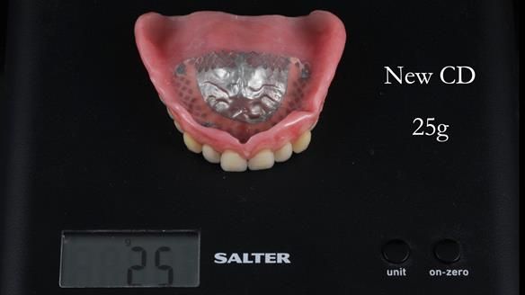 Finlay's Newsletter 62 provision of extractions and metal based complete dentures for Rafique