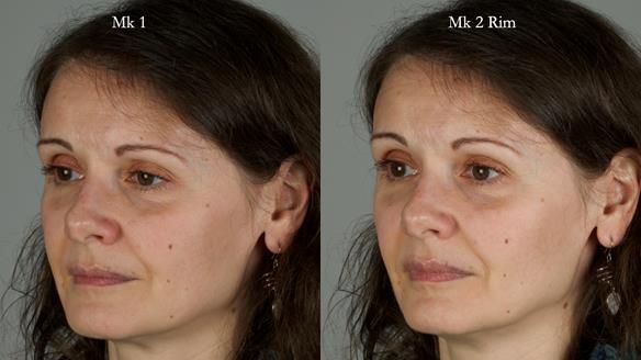 Newsletter 79 – Creating a wonderful smile and changing a life.