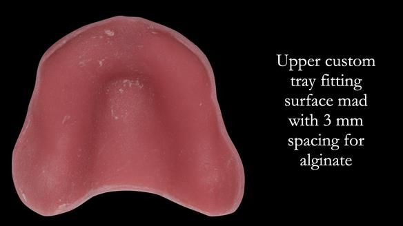 Newsletter 50 Special edition Complete Dentures FULL PROTOCOL