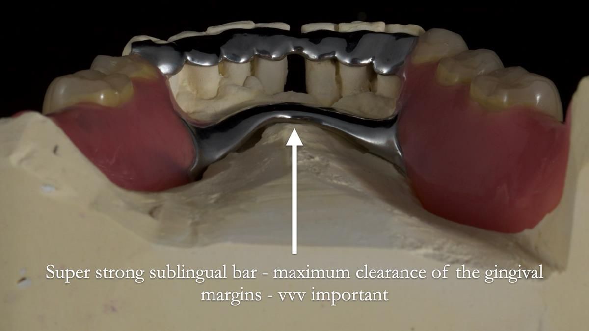 Newsletter 87 – Father Peter: A Partial Denture that needed Minor Miracle