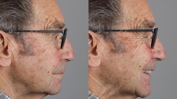 Newsletter 50 Special edition Complete Dentures FULL PROTOCOL