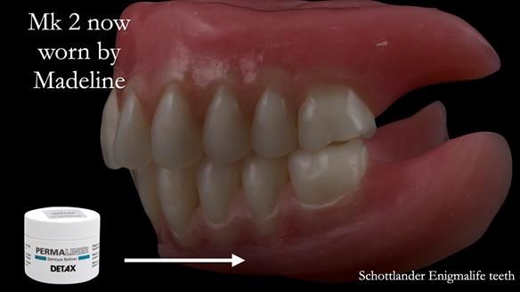 Replacing Madeline’s Complete denture FULL PROTOCOL