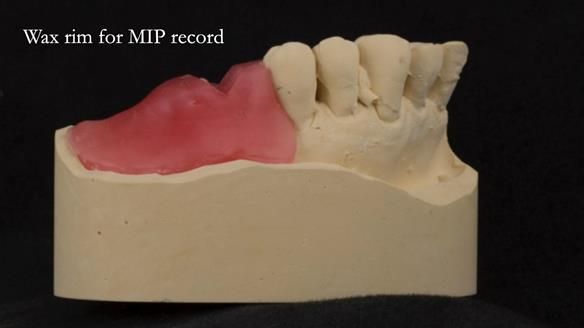 Ken – going downhill, first class