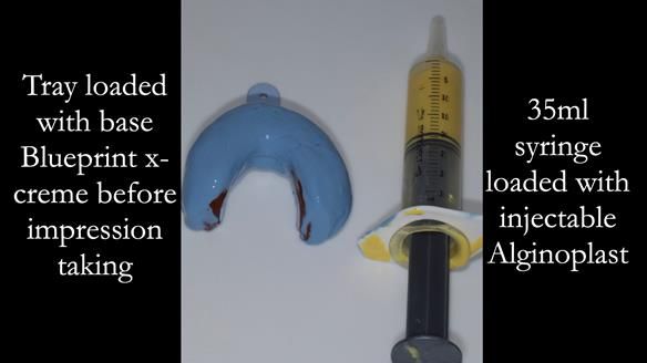 Newsletter 52 Managing Jo’s failing dentition with extractions and Mk 1/Mk 2 complete upper dentures and lower partial dentures FULL PROTOCOL