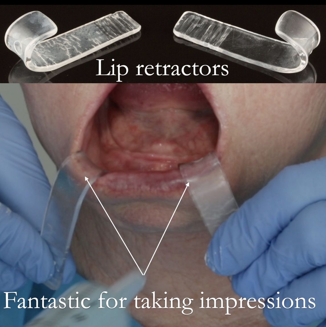 Simple tool for taking fantastic impressions
