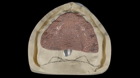 Newsletter 79 – Creating a wonderful smile and changing a life.