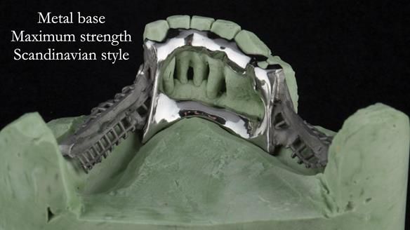 Ken – going downhill, first class