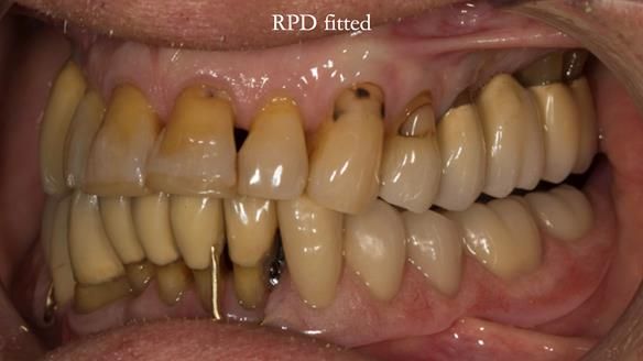 Ken – going downhill, first class