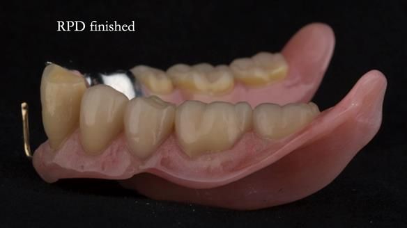 Ken – going downhill, first class