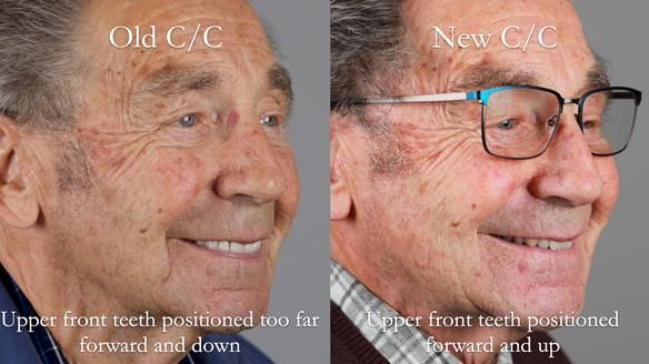 Newsletter 50 Special edition Complete Dentures FULL PROTOCOL