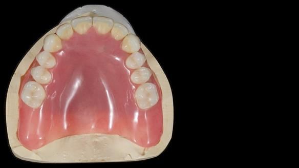 Newsletter 79 – Creating a wonderful smile and changing a life.