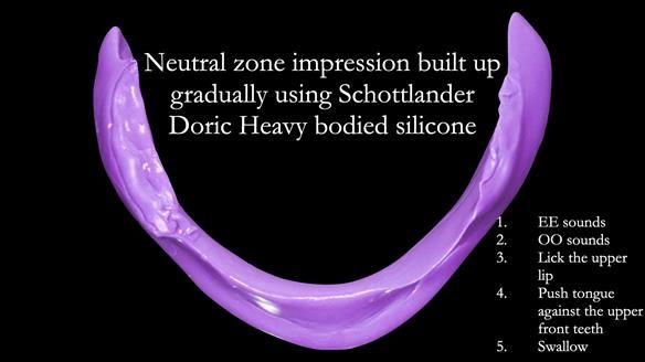 Replacing Madeline’s Complete denture FULL PROTOCOL