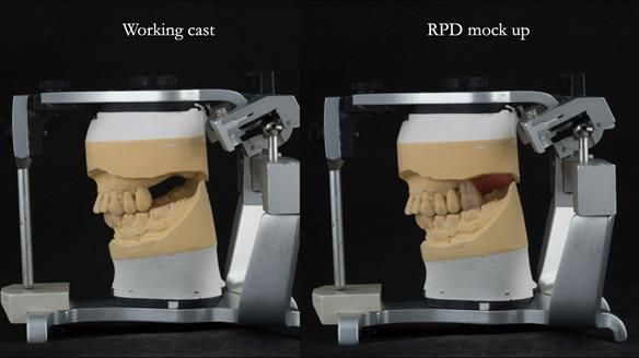 Ken – going downhill, first class