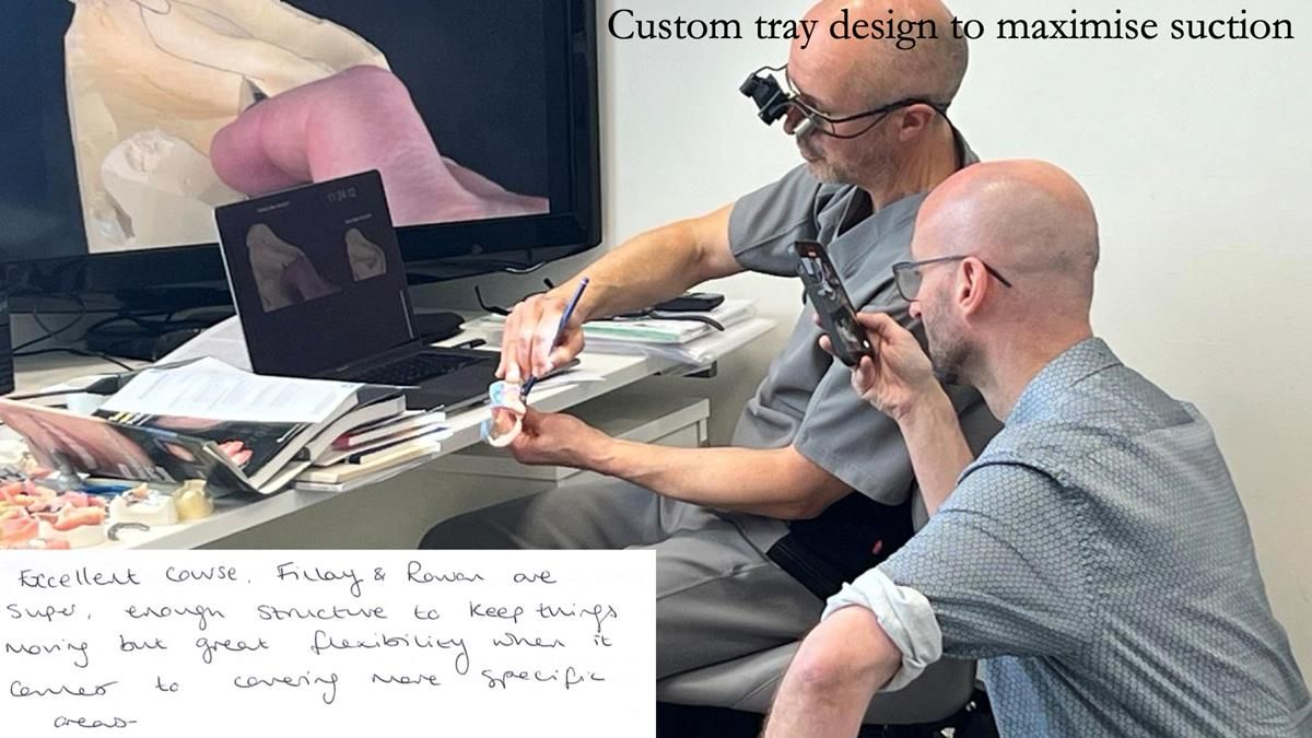 Finlay's Newsletter 64 case study - provision of a Kennedy class 2 metal based Scandinavian RPD for Ian
