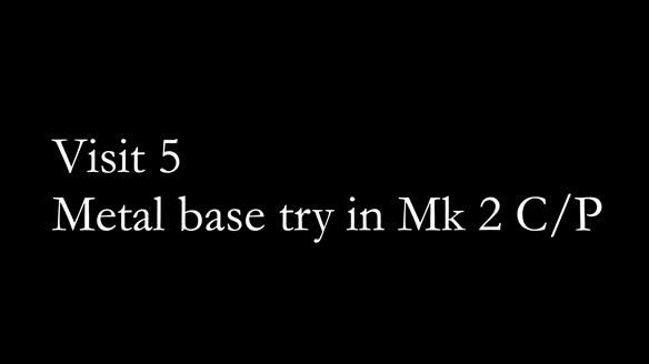 Newsletter 52 Managing Jo’s failing dentition with extractions and Mk 1/Mk 2 complete upper dentures and lower partial dentures FULL PROTOCOL