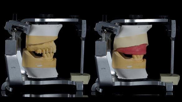 Newsletter 79 – Creating a wonderful smile and changing a life.