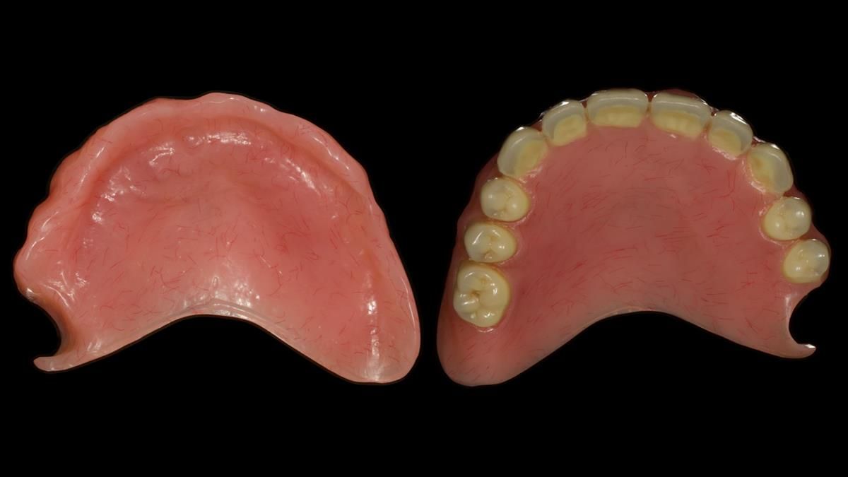 Newsletter 87 – Father Peter: A Partial Denture that needed Minor Miracle