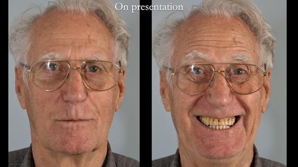 Ken – going downhill, first class