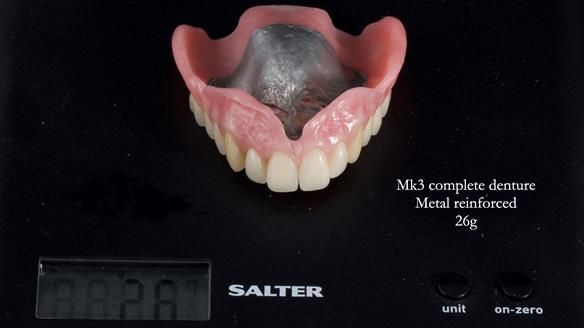 Newsletter 77: Jeremy’s case – immediate complete upper denture